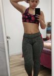 Weight Loss Surgery