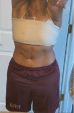 Fleur De Lys Tummy Tuck