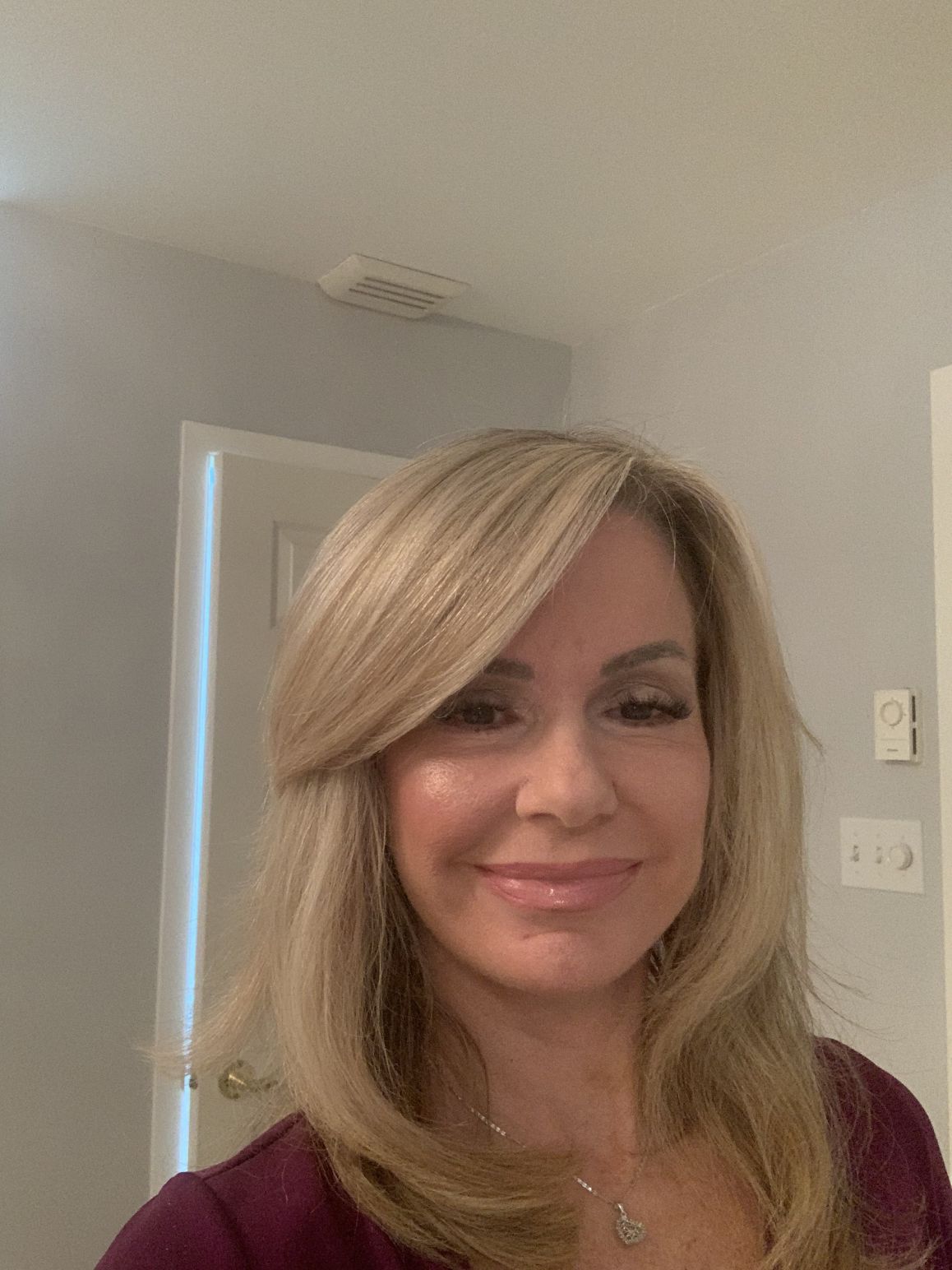 Full Face Lift w/ Eyelids