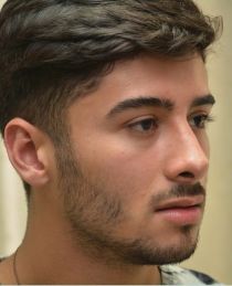 Rhinoplasty