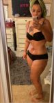 Fleur De Lys Tummy Tuck & Thigh Lift
