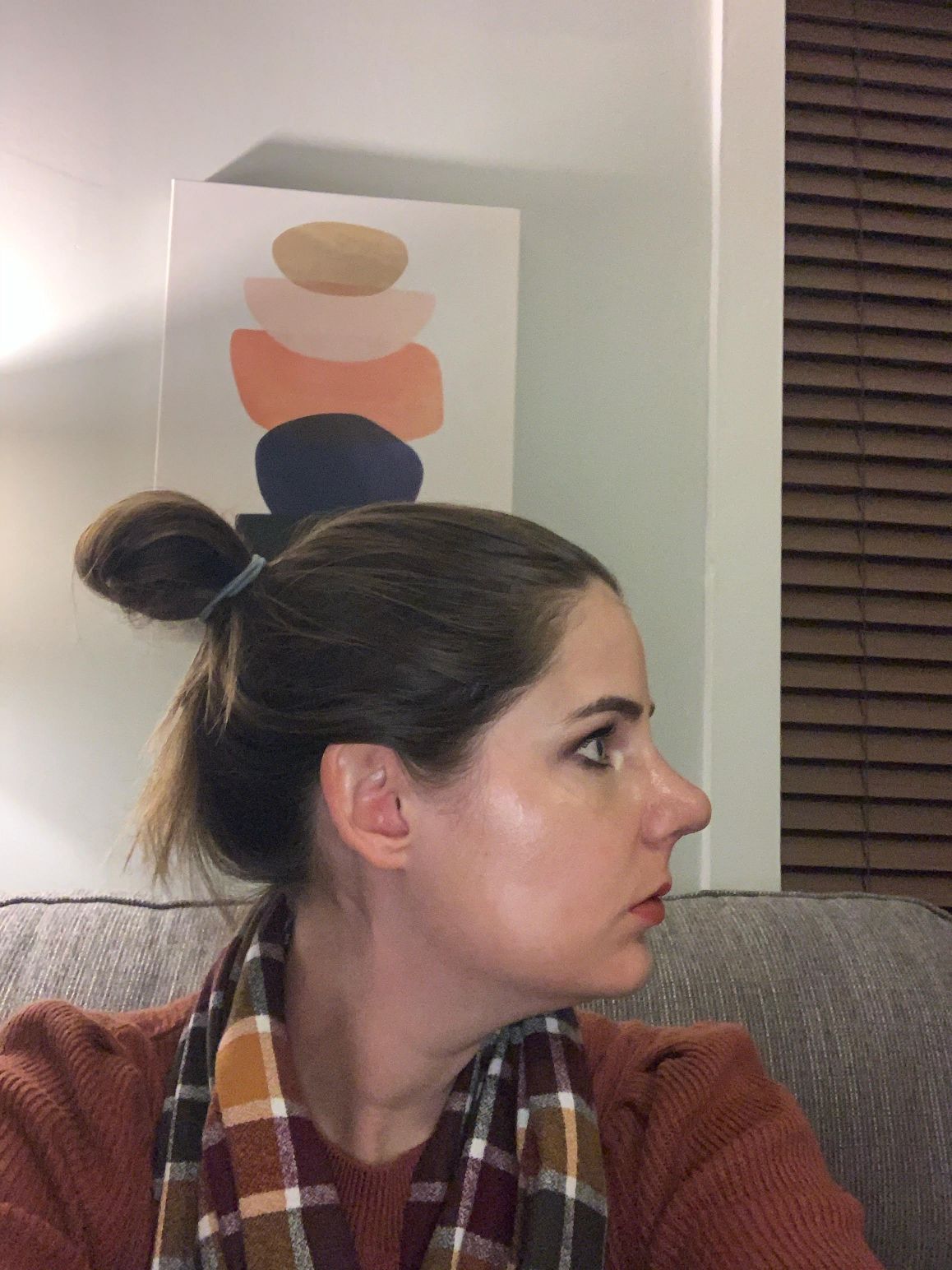 Rhinoplasty