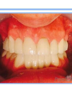 Oral Cosmetic Rehabilitation