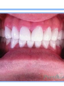 Oral Cosmetic Rehabilitation