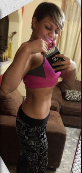 Weight-Loss Surgery