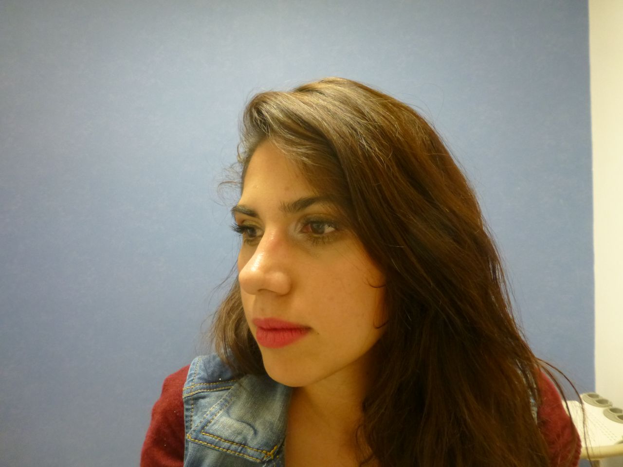 Rhinoplasty