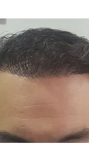 HAIR SPECIALIST