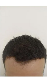 HAIR SPECIALIST
