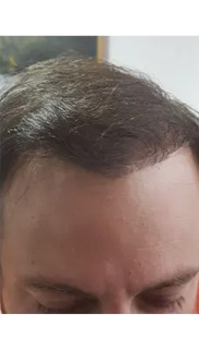 HAIR SPECIALIST
