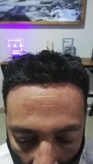 HAIR SPECIALIST