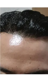 HAIR SPECIALIST