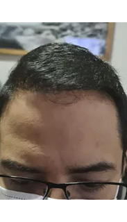 HAIR SPECIALIST
