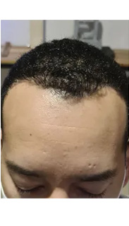 HAIR SPECIALIST