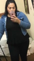 Weight Loss Surgery