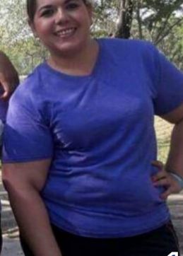 Weight Loss Surgery