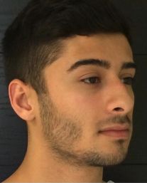 Rhinoplasty