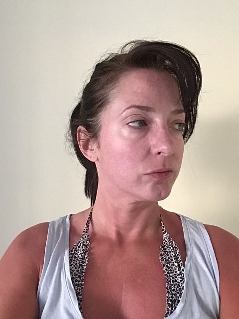 Full Face Lift w/ Eyelids