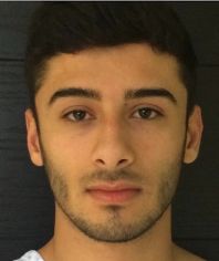 Rhinoplasty