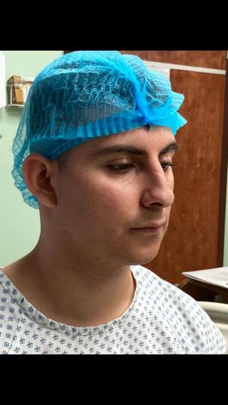 Rhinoplasty