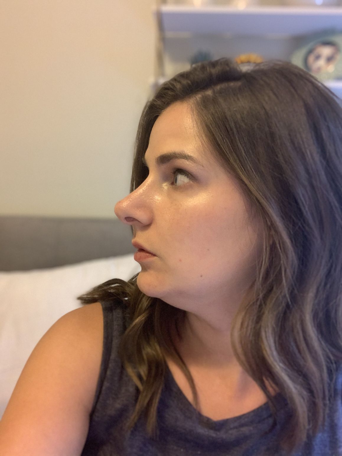 Rhinoplasty