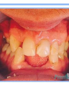 Oral Cosmetic Rehabilitation