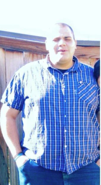 Weight-Loss Surgery