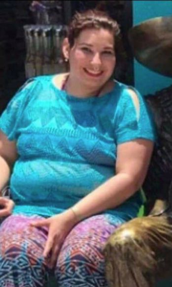 Weight-Loss Surgery