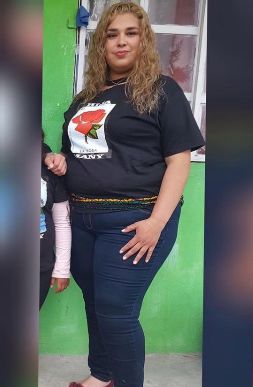 Weight-Loss Surgery