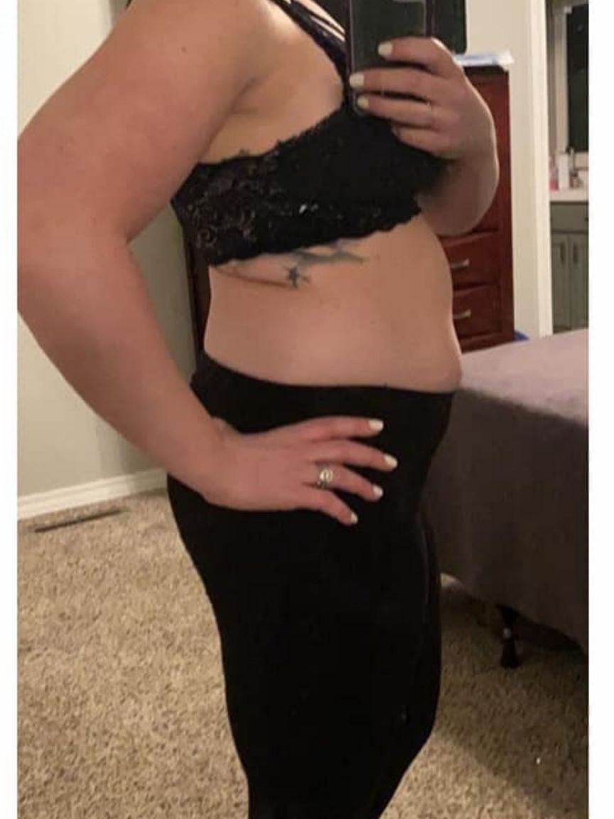 Mommy Makeover