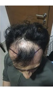 HAIR SPECIALIST