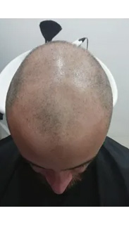 HAIR SPECIALIST