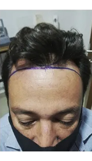 HAIR SPECIALIST