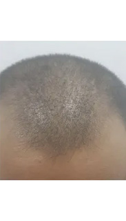 HAIR SPECIALIST