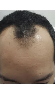 HAIR SPECIALIST