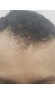 HAIR SPECIALIST