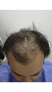 HAIR SPECIALIST